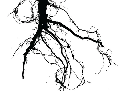 Two-dimensional (2D) imaging of soybean root system. Image courtesy of Sujata Bogati, first author on the study.